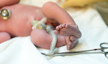 Immediate cord clamping at birth